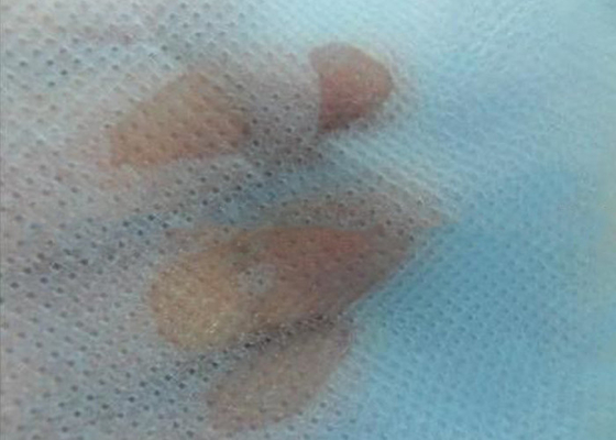 kaufen Ungiftiges Gewebes-umweltfreundliche hydrophobe SMSs nicht imprägniern für Windeln online manufacture